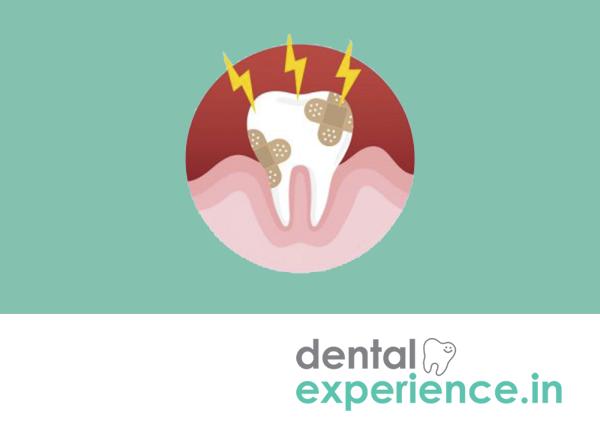Baby Tooth Concussion