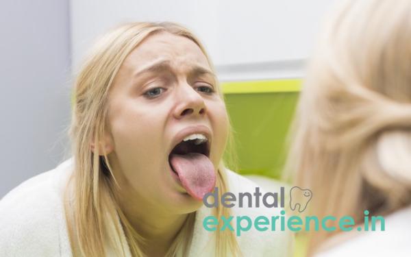 Burning Tongue