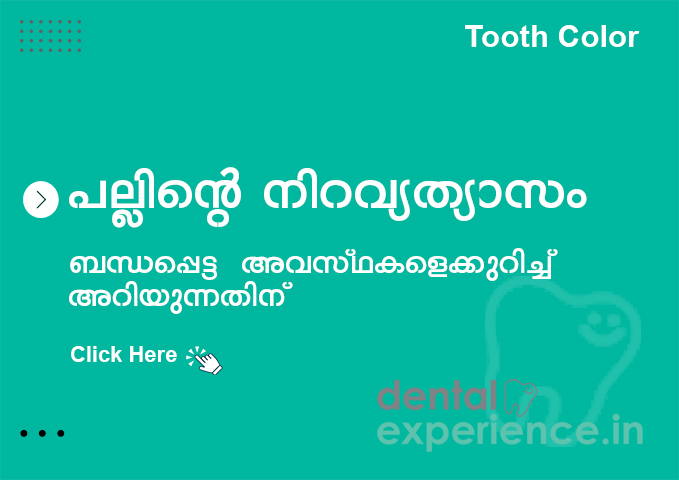 പല്ലിൻ്റെ നിറം