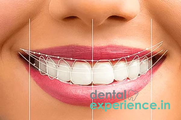 Digital Smile Design.