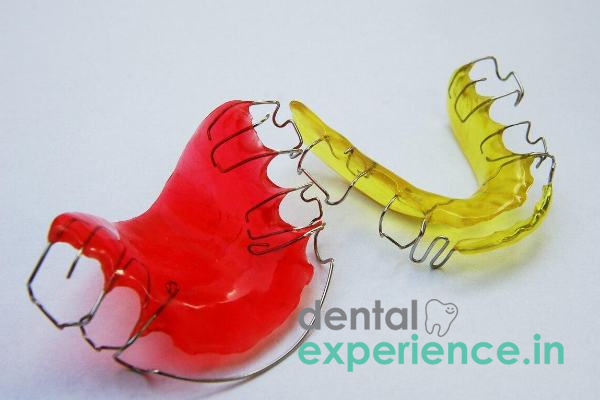 Dental Retainer