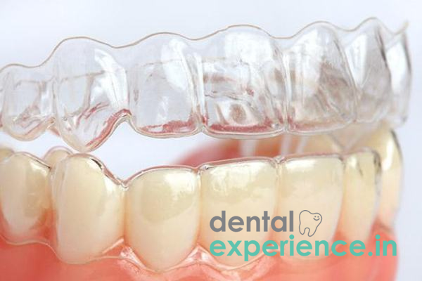 Clear Dental Aligners /invisalign