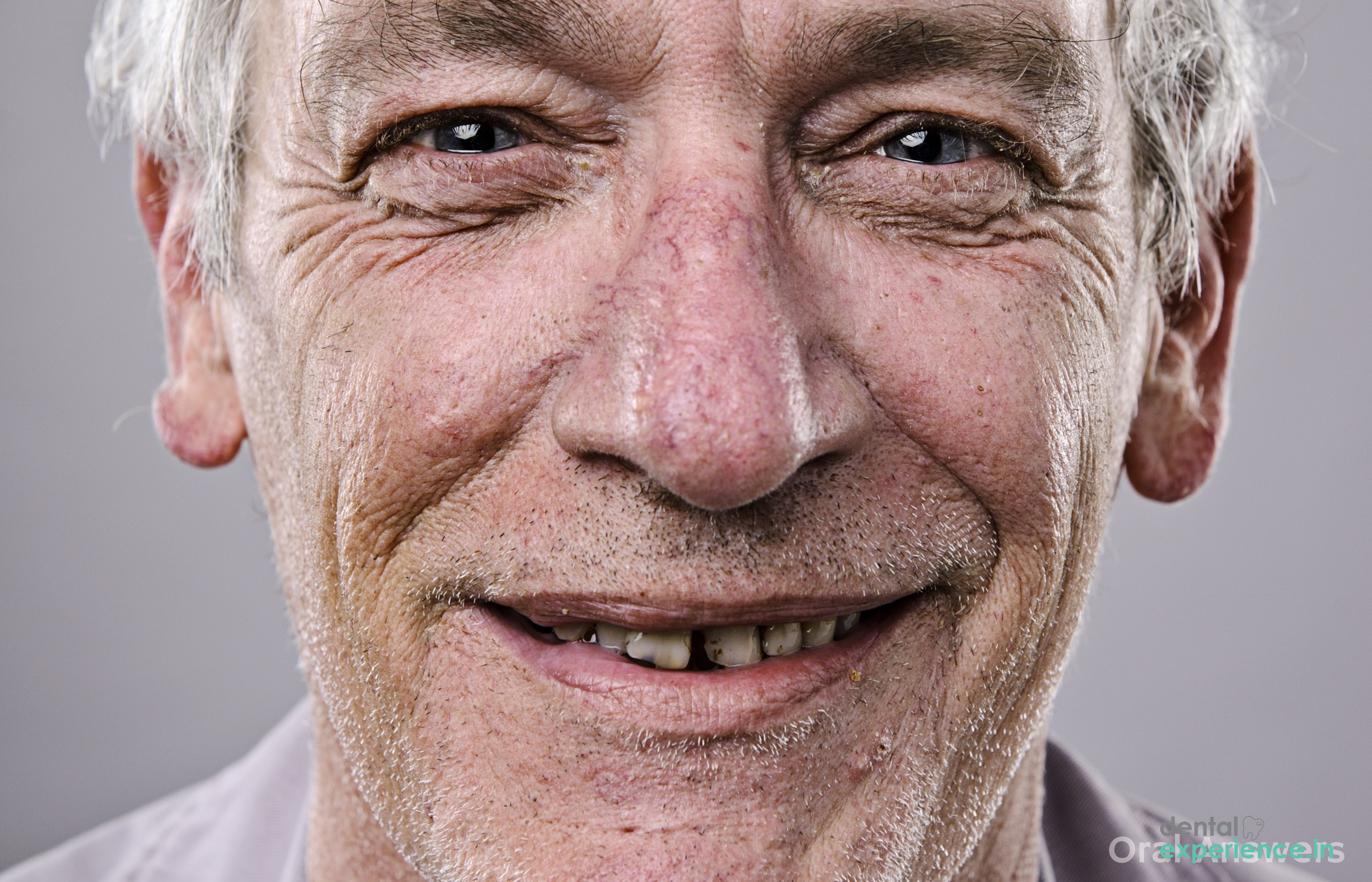 Aged looking smile