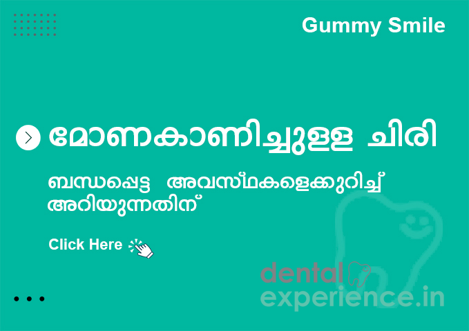 മോണകൾ കാണിക്കുന്ന പുഞ്ചിരി