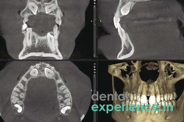 Cone Beam Computed Tomography (CBCT)
